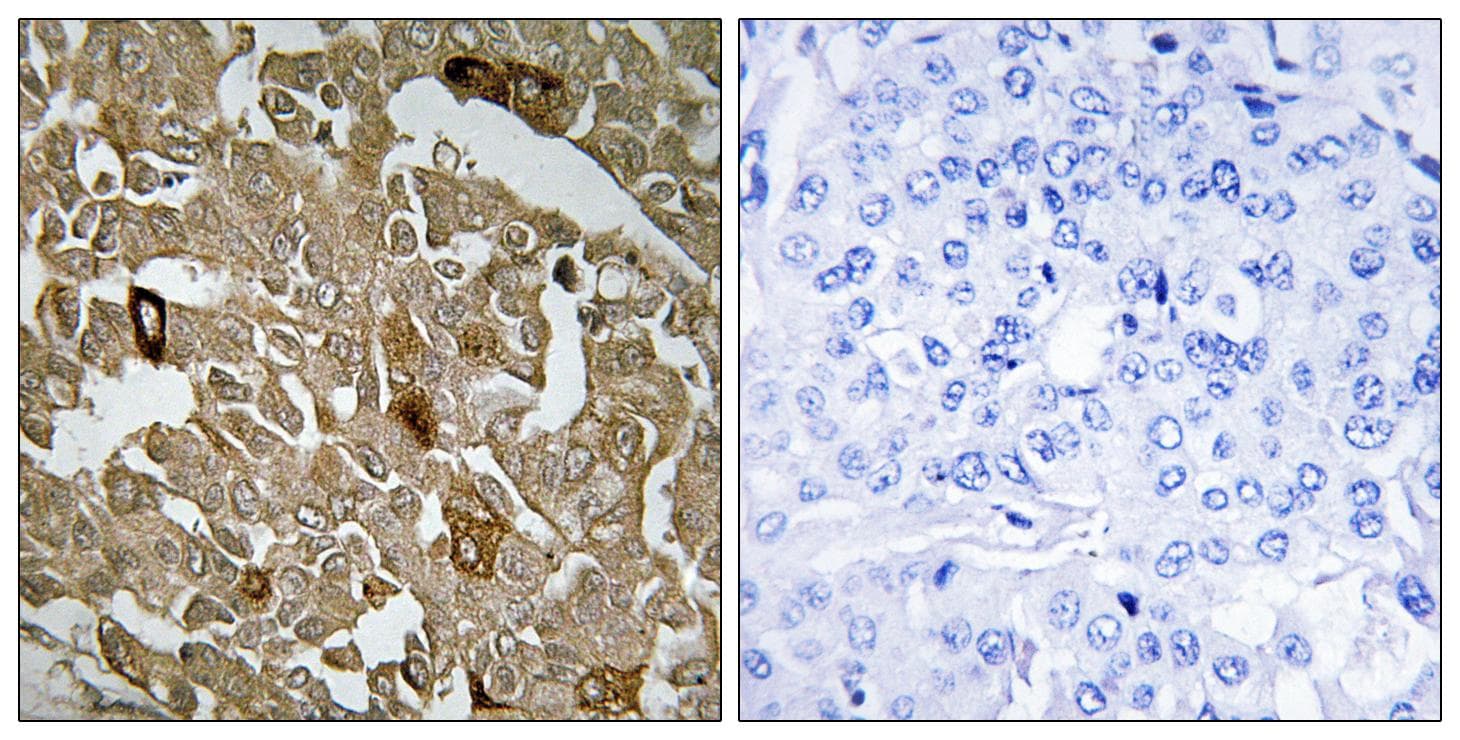 Polyclonal Rabbit anti-Human BTBD6 Antibody (IHC)