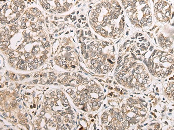 COA7 / SELRC1 Antibody