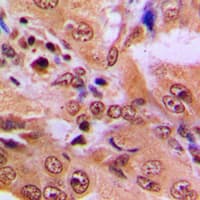 Polyclonal Rabbit anti-Human TP53 / p53 Antibody (Acetyl-Lys386, IHC, IF, WB)