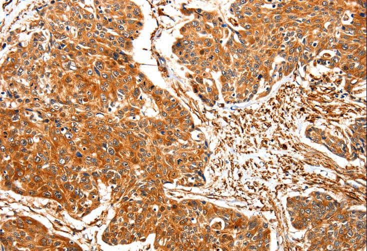 TPM2 Antibody