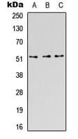 Polyclonal Rabbit anti-Human AcPL / IL18RAP Antibody (Internal, WB)