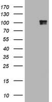 Monoclonal Mouse anti-Human c-Kit / CD117 Antibody (clone OTI3F9, aa546-976, IHC, WB)