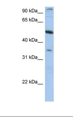TEM7 Antibody (aa74-123)