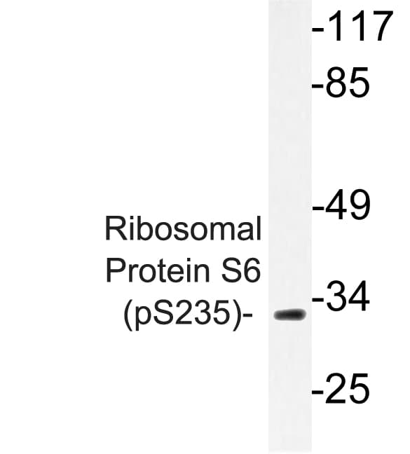 Polyclonal Rabbit anti-Human RPS6 / Ribosomal Protein S6 Antibody (phospho-Ser6, IF, WB)