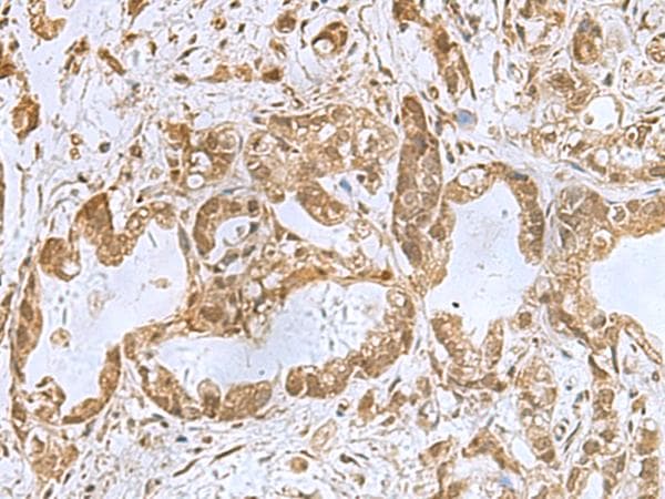 PHF6 Antibody