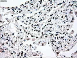 MAP2K2 / MKK2 / MEK2 Antibody (clone OTI5F6)