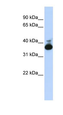 ALDOB Antibody (aa108-157)