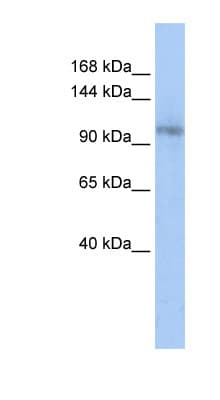 TCERG1 / CA150 Antibody (aa936-985)