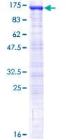 Human USP16 Protein (Recombinant GST)