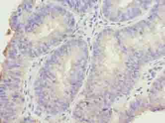 Polyclonal Rabbit anti-Human DDI2 Antibody (IHC, WB)