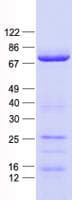 Human RIPK1 / RIP Protein (Recombinant His, N-Terminal)