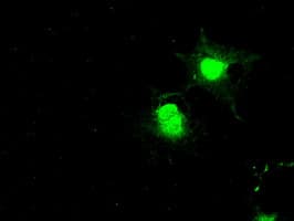 Monoclonal Mouse anti-Human BUB1B / BubR1 Antibody (clone OTI10B7, IHC, IF, WB)