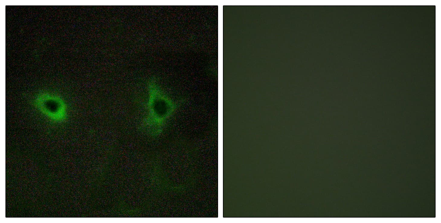 Polyclonal Rabbit anti-Human COL4A3 / Tumstatin Antibody (aa801-850, IHC, IF)