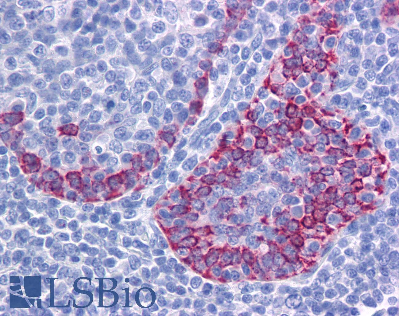 IHC-plus™ Polyclonal Rabbit anti-Human CRACR2B / EFCAB4A Antibody (IHC, WB)