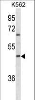 ABO Glycosyltransferase Antibody (aa41-68)