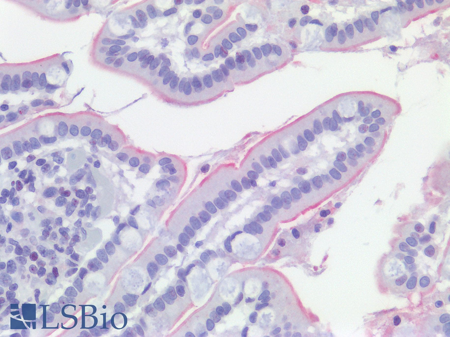 IHC-plus™ ACE2 / ACE-2 Antibody (aa140-172)