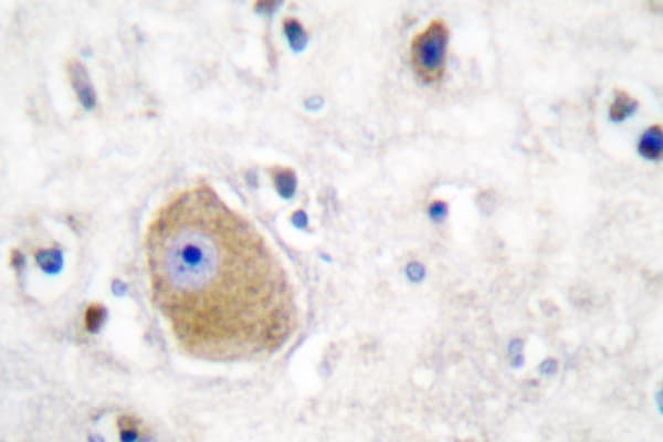 HSD17B10 / HADH2 Antibody (Glu135)
