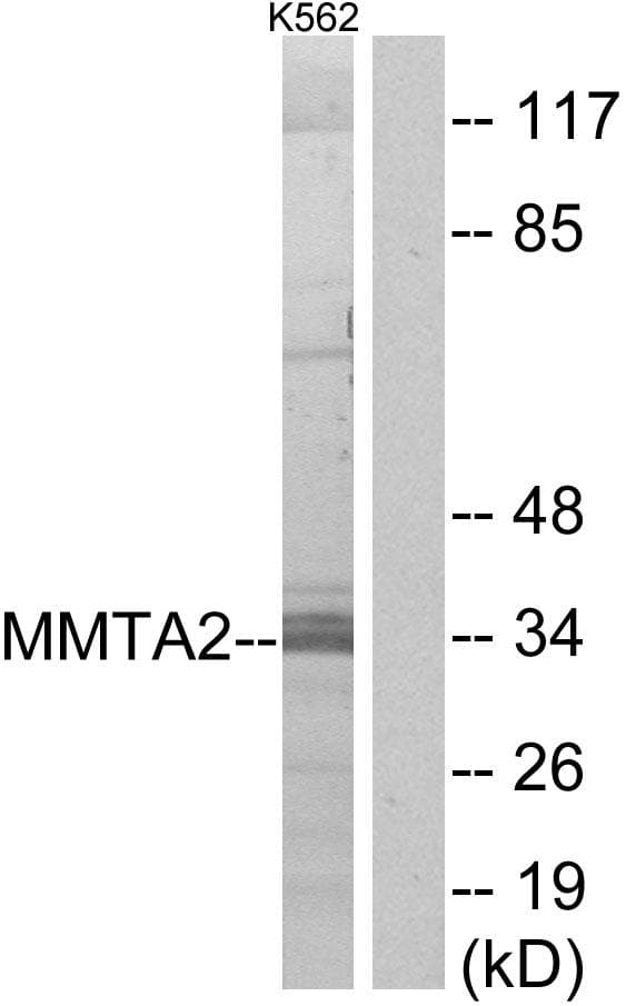 C1orf35 / MMTAG2 Antibody