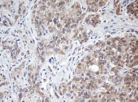 ARL2BP / BART Antibody (clone OTI4C4)