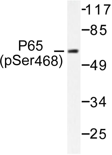 RELA / NFKB p65 Antibody (phospho-Ser468)
