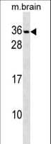 Polyclonal Rabbit anti-Human PAFAH1B2 Antibody (aa61-89, WB)