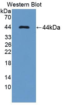 DHPS Antibody (aa1-369, FITC)