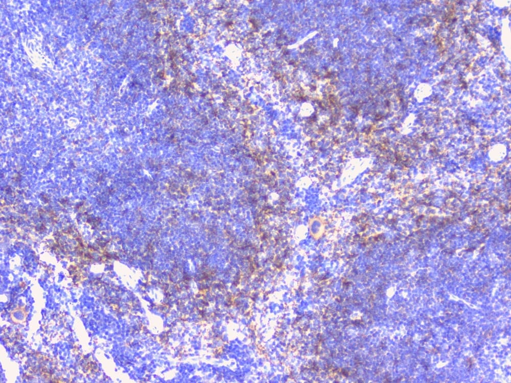 Polyclonal Rabbit anti-Human PTP1B Antibody (IHC, WB)