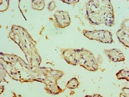 Polyclonal Rabbit anti-Human DPP2 / DPP7 Antibody (aa190-410, IHC, WB)