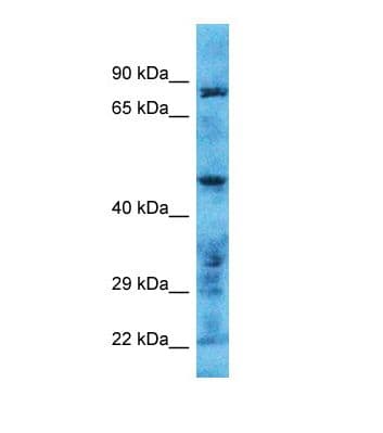 Polyclonal Rabbit anti-Human TMPRSS11B Antibody (aa60-109, WB)