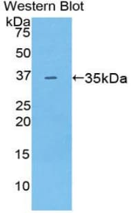 CD2AP Antibody (aa149-429, FITC)
