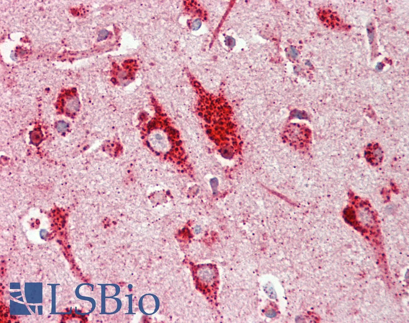 IHC-plus™ RASD2 Antibody (aa86-114)