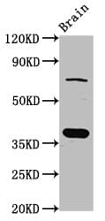 SCAMP1 / SCAMP Antibody