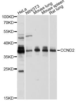 IHC-plus™ CCND2 / Cyclin D2 Antibody