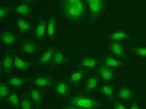 CETN2 / Centrin 2 Antibody