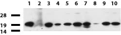 NME1 / NM23 Antibody (clone UMAB91, Carrier-free)