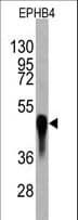 Monoclonal Mouse anti-Human EPHB4 / EPH Receptor B4 Antibody (clone 67CT23.5.8, WB)