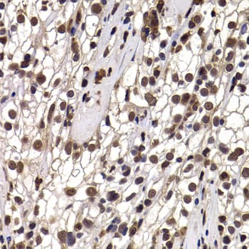 DDX21 Antibody
