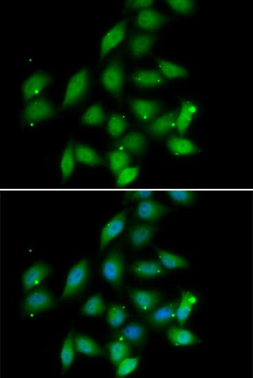 Polyclonal Rabbit anti-Human PP2Ac / PPP2CA Antibody (IHC, IF, WB)