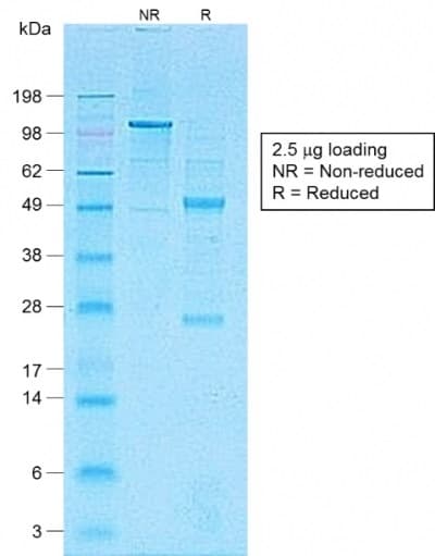 PathPlus™ CD1A Antibody (clone C1A/1506R)