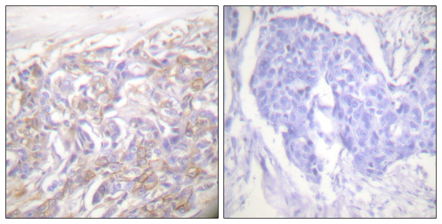 TNFRSF1A / TNFR1 Antibody (aa381-430)