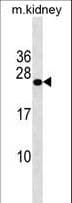 GRPEL2 Antibody (aa14-43)