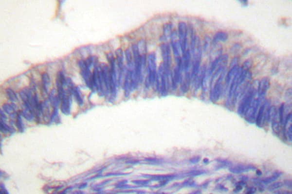 GRB4 / NCK2 Antibody (Ile364)