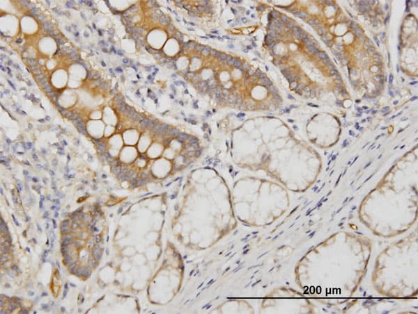 CDC42BPB / MRCKB Antibody (clone 2F4)