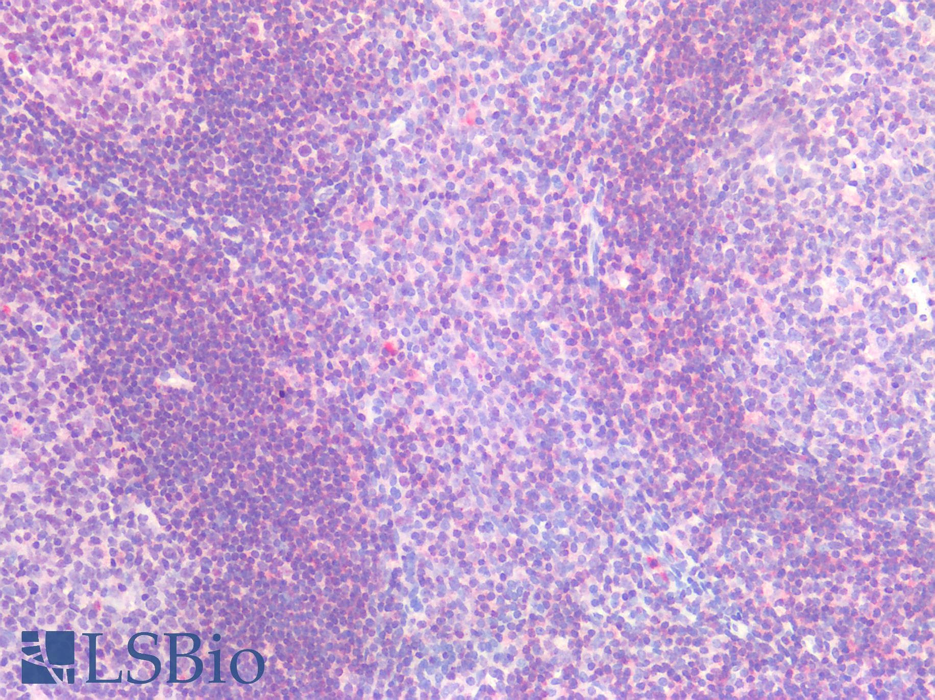 IHC-plus™ IL6R / IL6 Receptor Antibody