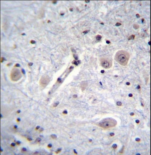 MARK1 / MARK Antibody (aa643-674)