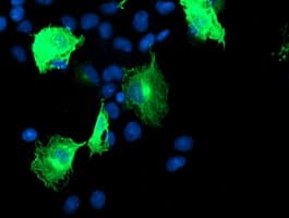CCM2 / Malcavernin Antibody (clone OTI3B7)