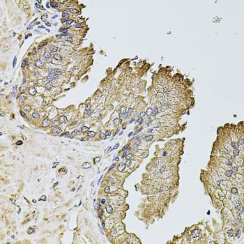 Polyclonal Rabbit anti-Human PTCD3 Antibody (IHC, WB)