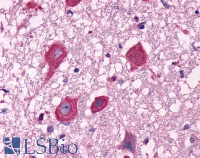 PathPlus™ FFAR1 / GPR40 Antibody (C-Terminus)
