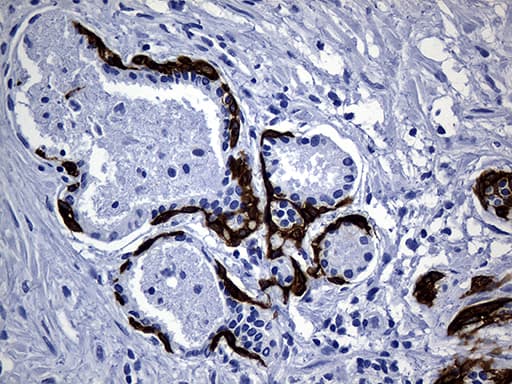 Monoclonal Mouse anti-Human KRT14 / CK14 / Cytokeratin 14 Antibody (clone OTI5F2, Carrier-free, aa261-472, IHC, WB)