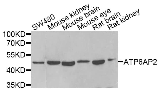 Polyclonal Rabbit anti-Human ATP6AP2 / Renin Receptor Antibody (IF, WB)